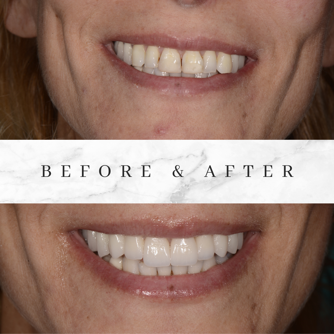 Purple Abstract Modern Skincare Before and After Instagram Post